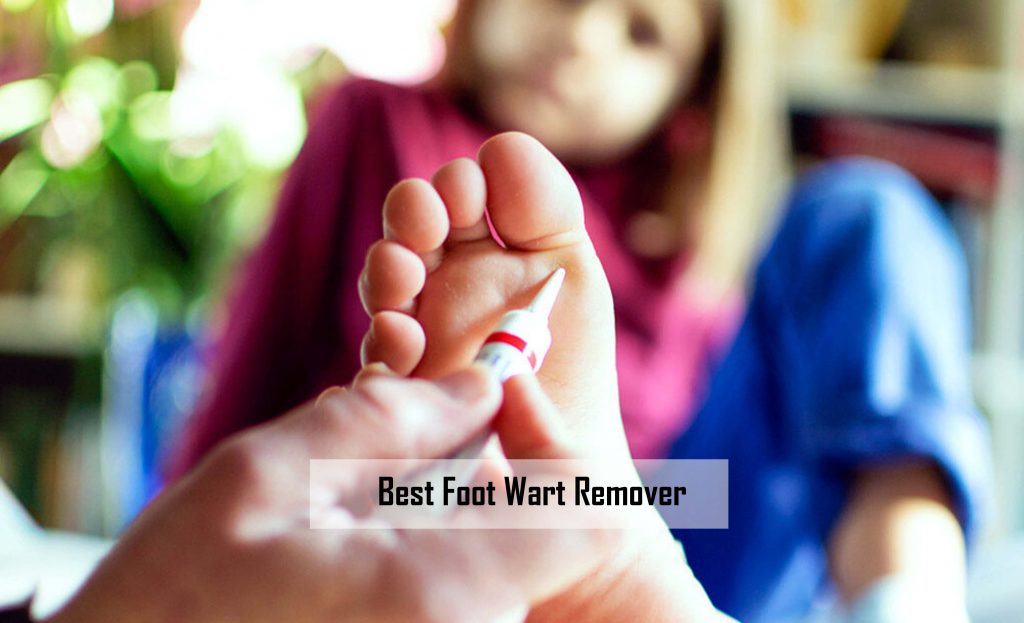 Best Foot Wart Remover