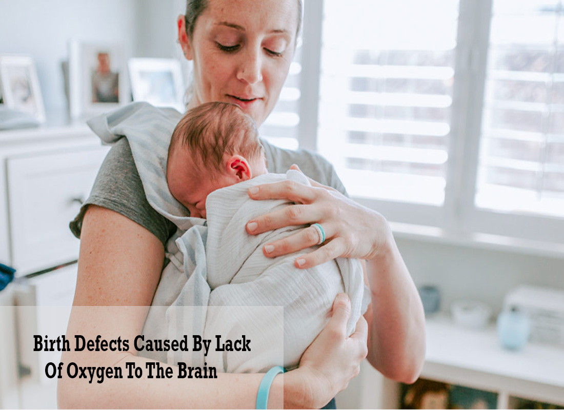 Birth Defects Caused By Lack Of Oxygen To The Brain