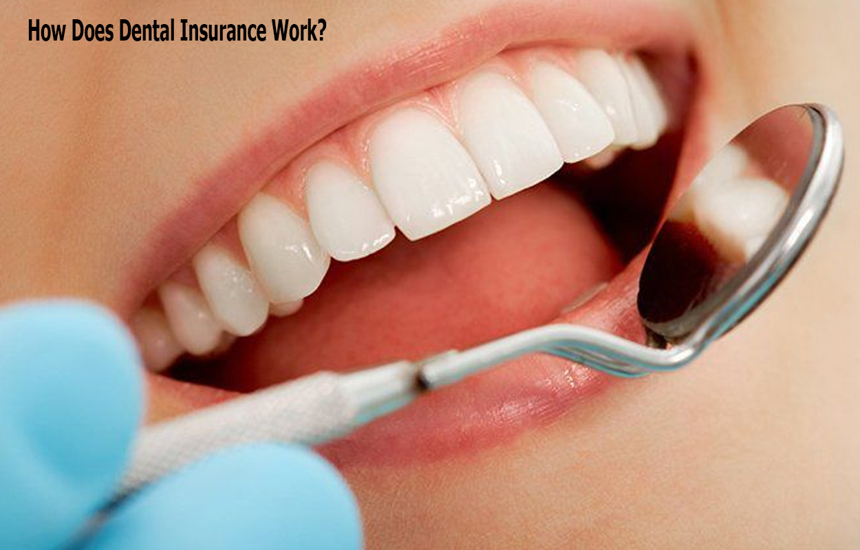 How Does Dental Insurance Work