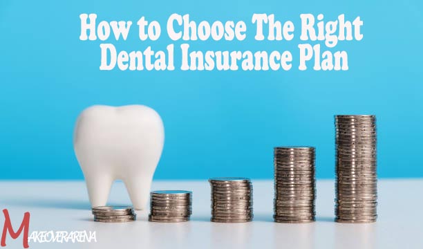 How to Choose The Right Dental Insurance Plan